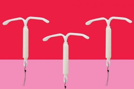 Ưu – nhược điểm của vòng tránh thai nội tiết