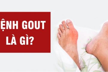 Bệnh Gout: Nguyên nhân, triệu chứng và cách điều trị