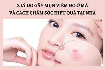 Tại sao lại xuất hiện mụn viêm đỏ trên má? Cách chăm sóc da mụn viêm đúng chuẩn y khoa