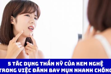 5 tác dụng thần kỳ của kem nghệ trong việc đánh bay mụn nhanh chóng